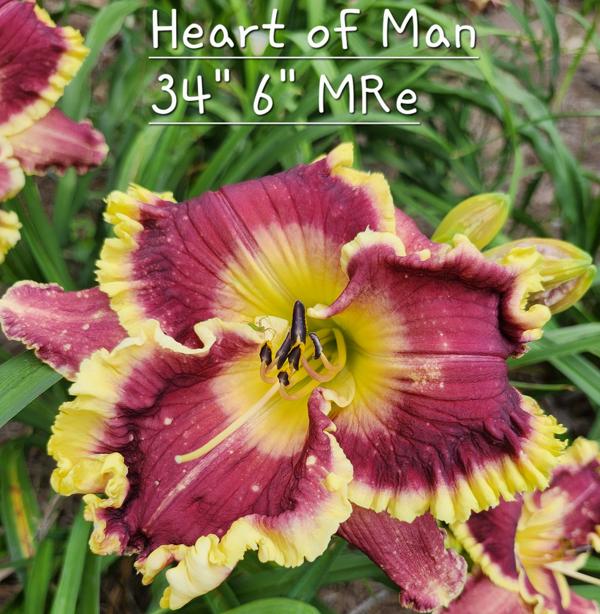 Heart of Man (3)